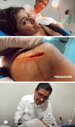 Paulina Peña sufrió accidente